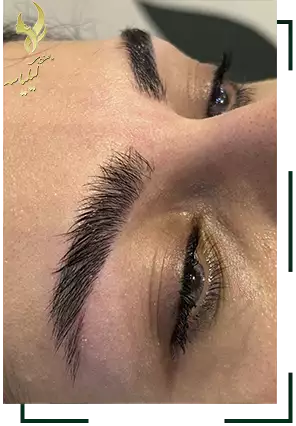 قبل و بعد اصلاح ابرو