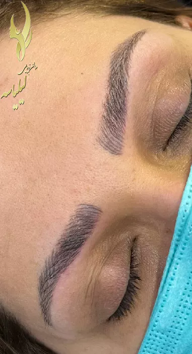 قرینه سازی ابرو در مشهد